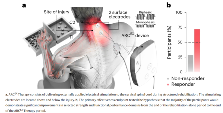 Helping the paralyzed move – Healthcare Economist