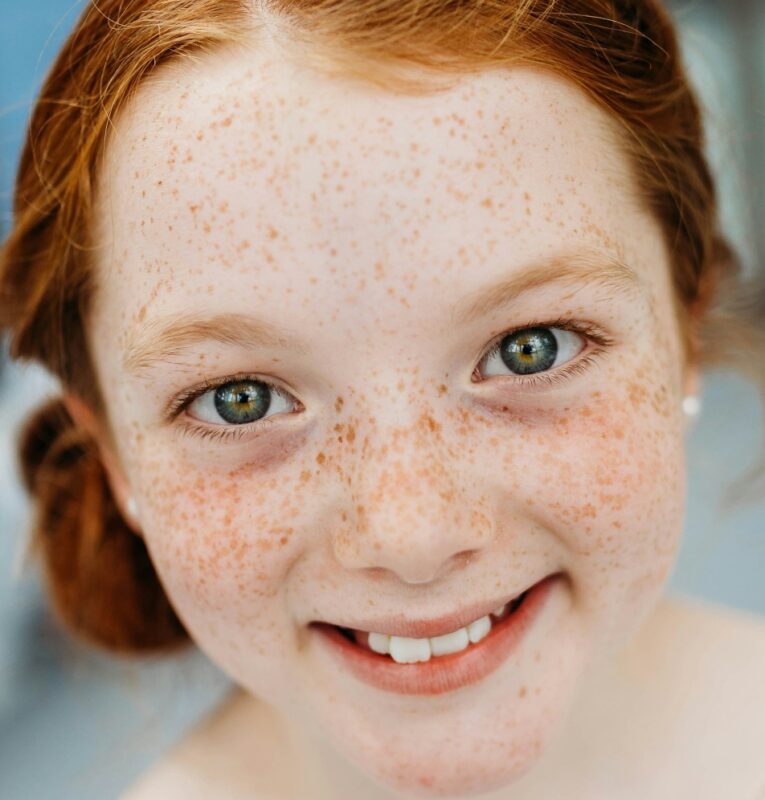 Children With Measles