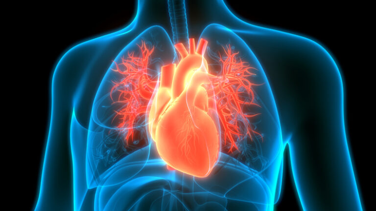 Death in Rocket Pharma Gene Therapy Study Puts Spotlight on Trial Change Intended to Improve Safety