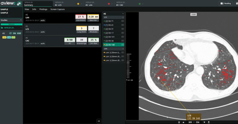 Coreline Soft scores imaging AI supply contracts with UK NHS, Boehringer Ingelheim and more briefs