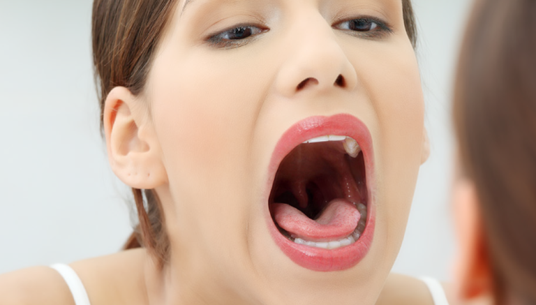 Why Your Mouth Shows Whole-Body Symptoms