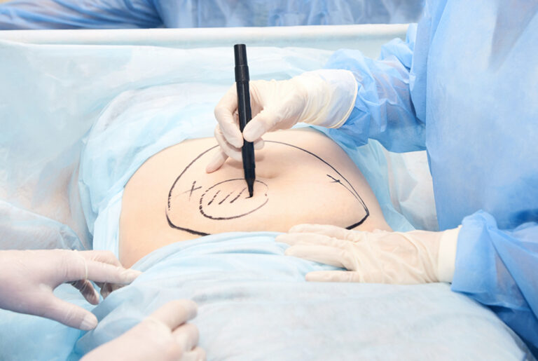 What to Expect During Your Visit to a Modern Colorectal Clinic